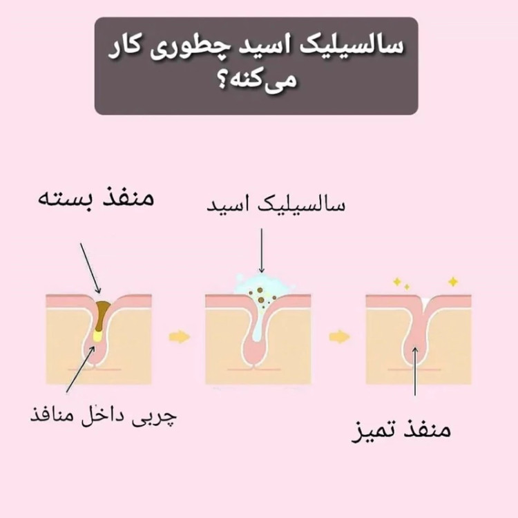 ماسک سالیسیلیک اسید بیوآکوا اصلی (ضد جوش و مناسب برای پوست جوش دار و مستعد جوش) مدل new kanada051