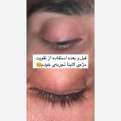 لوسیون تقویت مژه اصل اورجینال سرم تقویتی مژه ها و ابرو پرپشت کننده ضد ریزش بلند کننده ضخیم کننده مژه ها و ابرو ها چشم مدل:new kanada01413